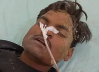 फिरोजाबाद: पत्नी ने पति को जबरन पिलाया मच्छर लोशन, हालत गंभीर